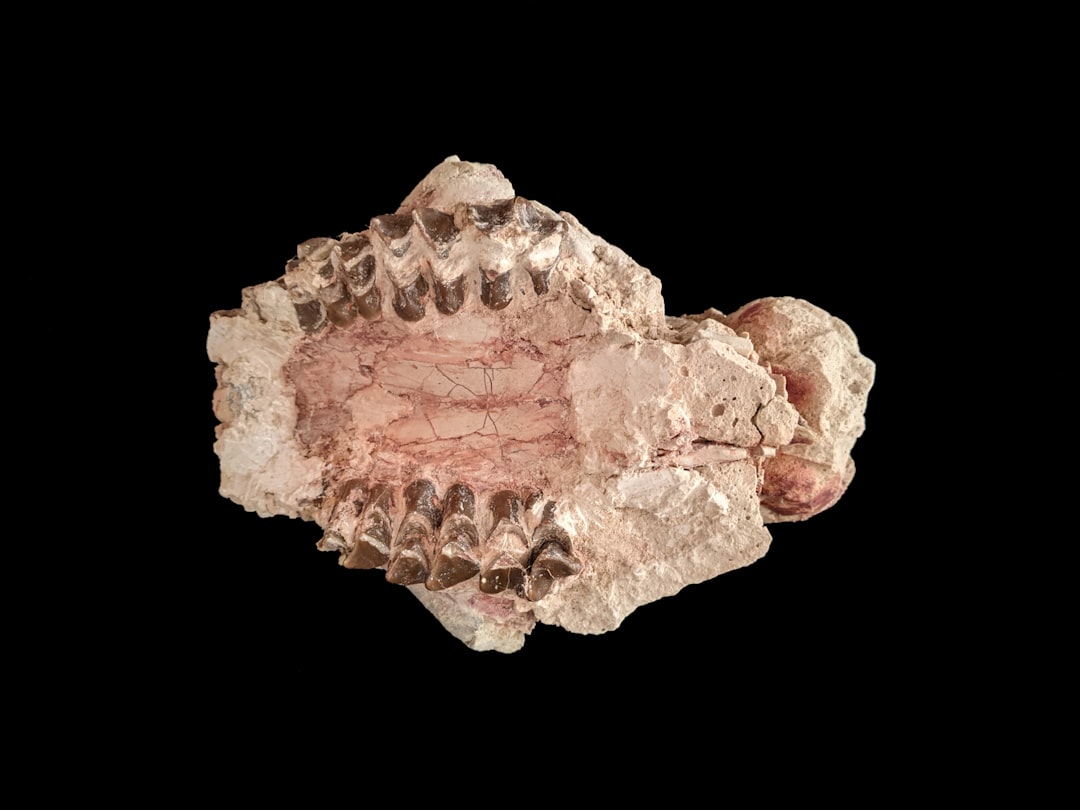 Waarom een wortelkanaalbehandeling soms nodig is